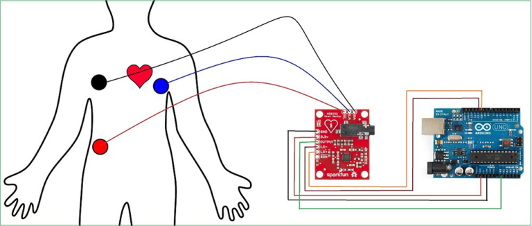 Módulo Sensor ECG AD8232 con Cable y Electrodos para Arduino - vista 3